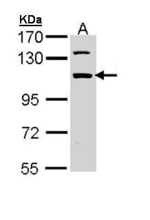 RBM28 Rabbit Polyclonal Antibody