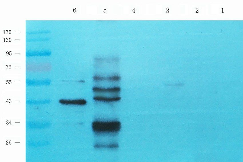RBM4 Rabbit Polyclonal Antibody