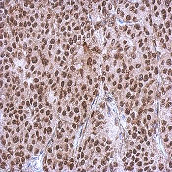 RBM4 antibody