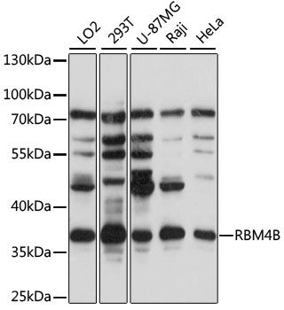 RBM4B antibody