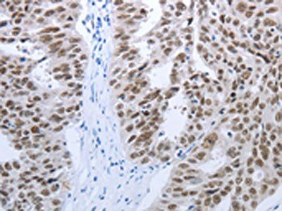 RBMS1 Antibody