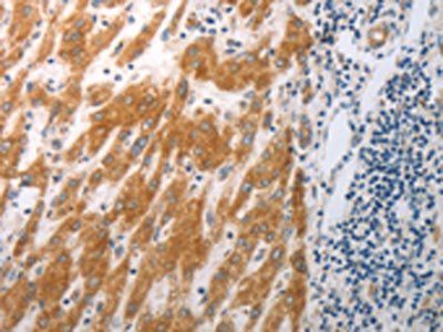 RBMS3 Antibody