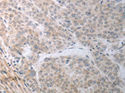 RBMS3 Antibody