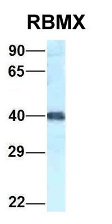RBMX antibody