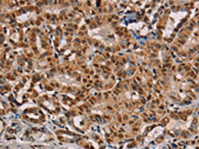 RBMX Antibody