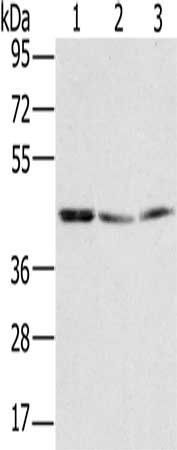 RBMX Antibody