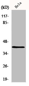 RBMX Antibody