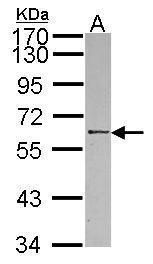 CRLF1 Rabbit Polyclonal Antibody