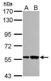 RBMY1A1 Rabbit Polyclonal Antibody