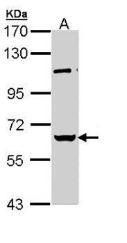 RBMY1A1 antibody