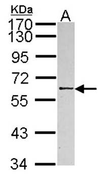 RBMY1A1 antibody