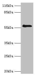 RBMY1F antibody