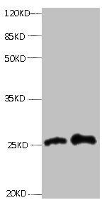 RBP4 Monoclonal Antibody
