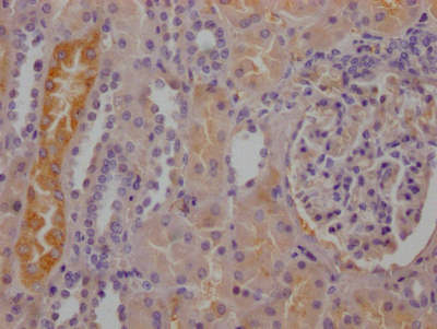 RBP4 Recombinant Monoclonal Antibody