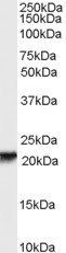 Goat anti-RBP4 Antibody