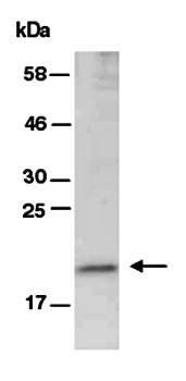 RBP4 (C) Antibody, Rabbit Polyclonal
