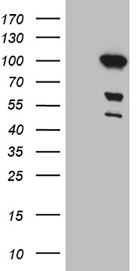 RBPJK (RBPJ) antibody