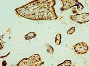 RBX1 antibody