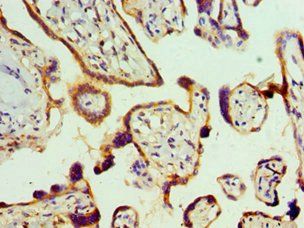 RBX1 Antibody