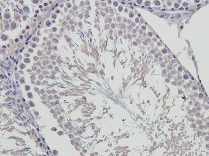 RCAN1 Rabbit Polyclonal Antibody