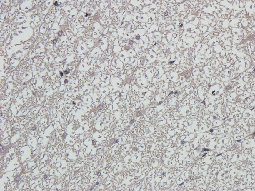 RCAN1 antibody