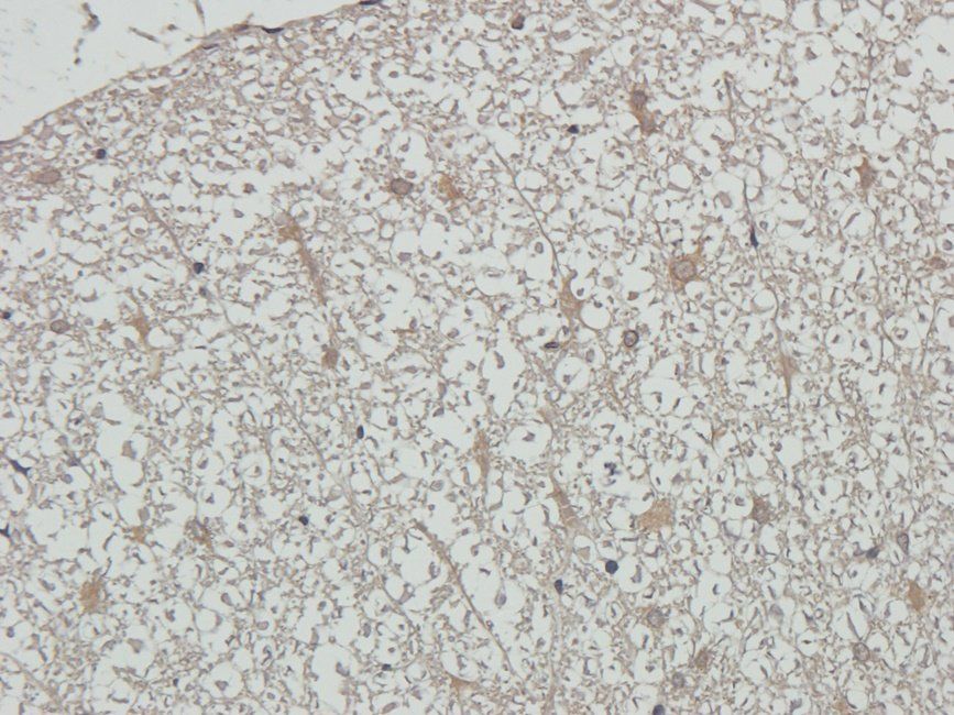 RCAN1 antibody