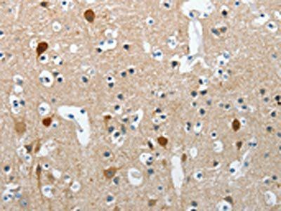 RCAN2 Antibody