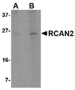 RCAN2 Antibody