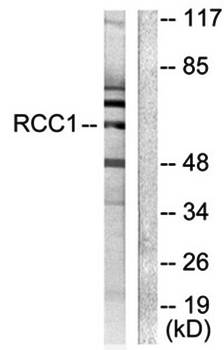RCBTB1 antibody