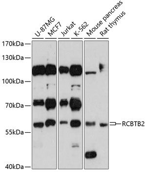 RCBTB2 antibody