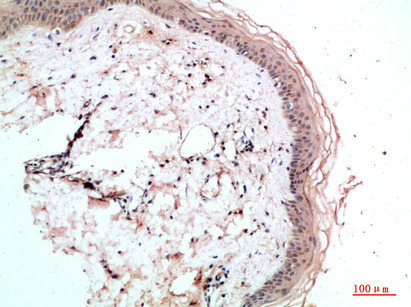 RCC1 Antibody