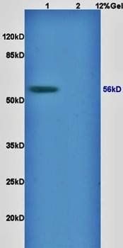 RCC2 Rabbit Polyclonal Antibody