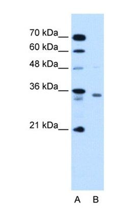 RCE1 antibody
