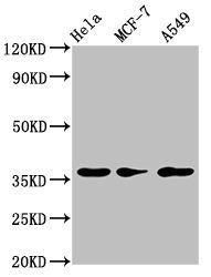 RCE1 Antibody