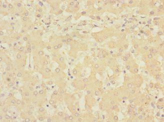RCHY1 Antibody