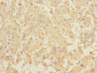 RCHY1 Antibody