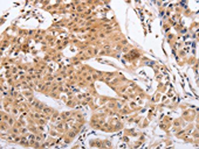 RCHY1 Antibody