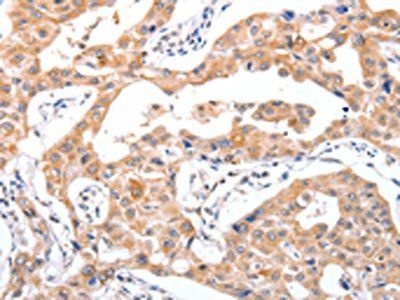 RCHY1 antibody