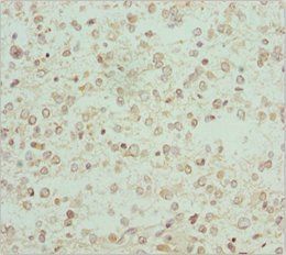 RCN2 Antibody