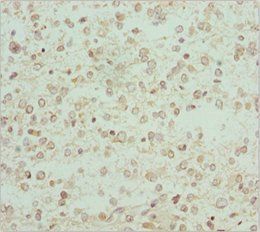 RCN2 antibody