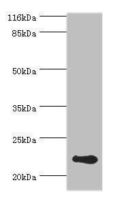 RCVRN antibody