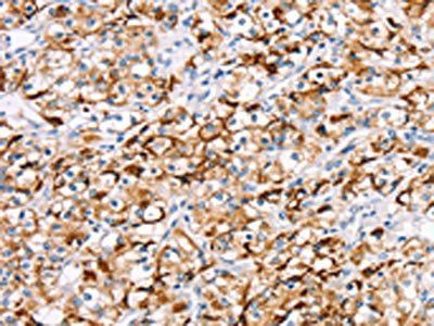 RDH11 antibody