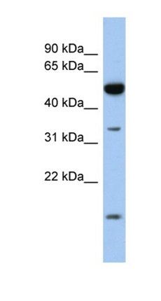 RDH12 antibody