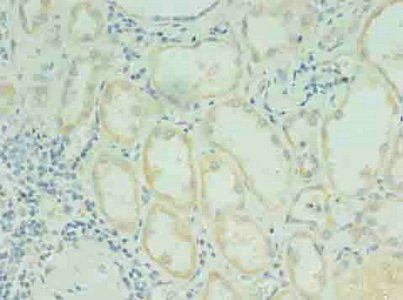 RDH12 Antibody
