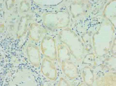 RDH12 antibody