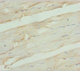 RDH12 Antibody