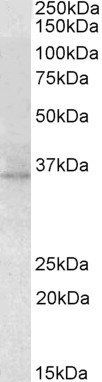 RDH5 antibody