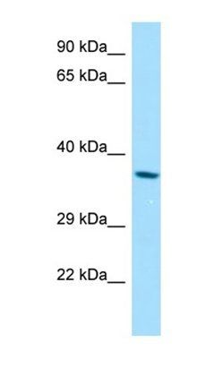RDH8 antibody