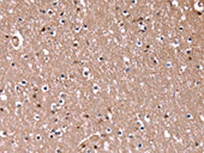 RDX Antibody