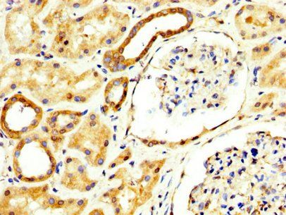RECK Antibody
